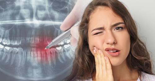 Cómo saber si tienes un diente muerto y qué hacer ante eso