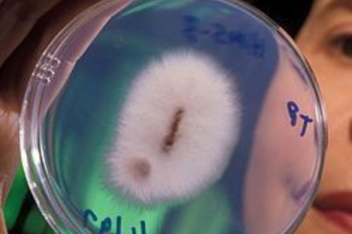 hongo Además del banano, este tipo de hongos ha comenzado a mostrar resistencia a los fungicidas tradicionales, lo que complica aún más el control (Pinterest)