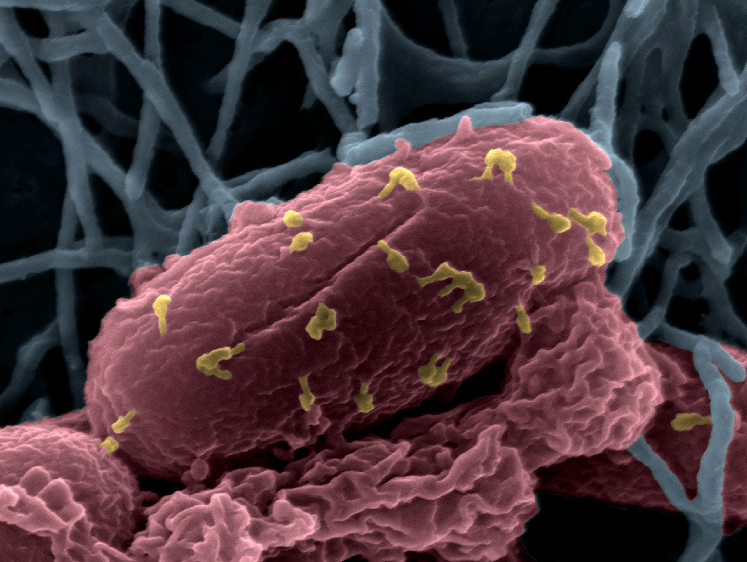 El fageoma es el conjunto de virus bacteriófagos que habitan el intestino humano. (noticiasdebariloche.com.ar)