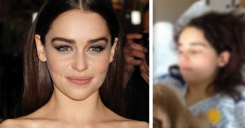 emilia clarke game of thrones aneurisma emilia clarke game of thrones aneurisma