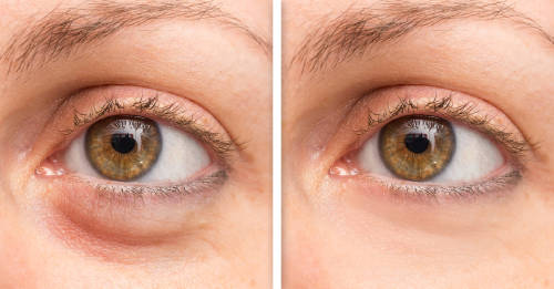 Esta es la vitamina que necesitas para acabar con las ojeras de una vez por todas | bioguia