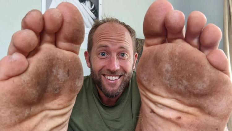 robin green field sus pies_98 robin green field sus pies_98