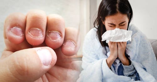 uñas pueden ser clave entender resfriado siempre uñas pueden ser clave entender resfriado siempre