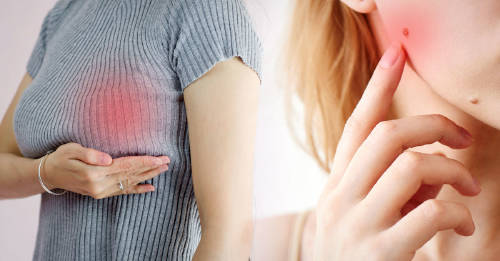5 autoexámenes que todas las mujeres deben hacerse para cuidar su salud