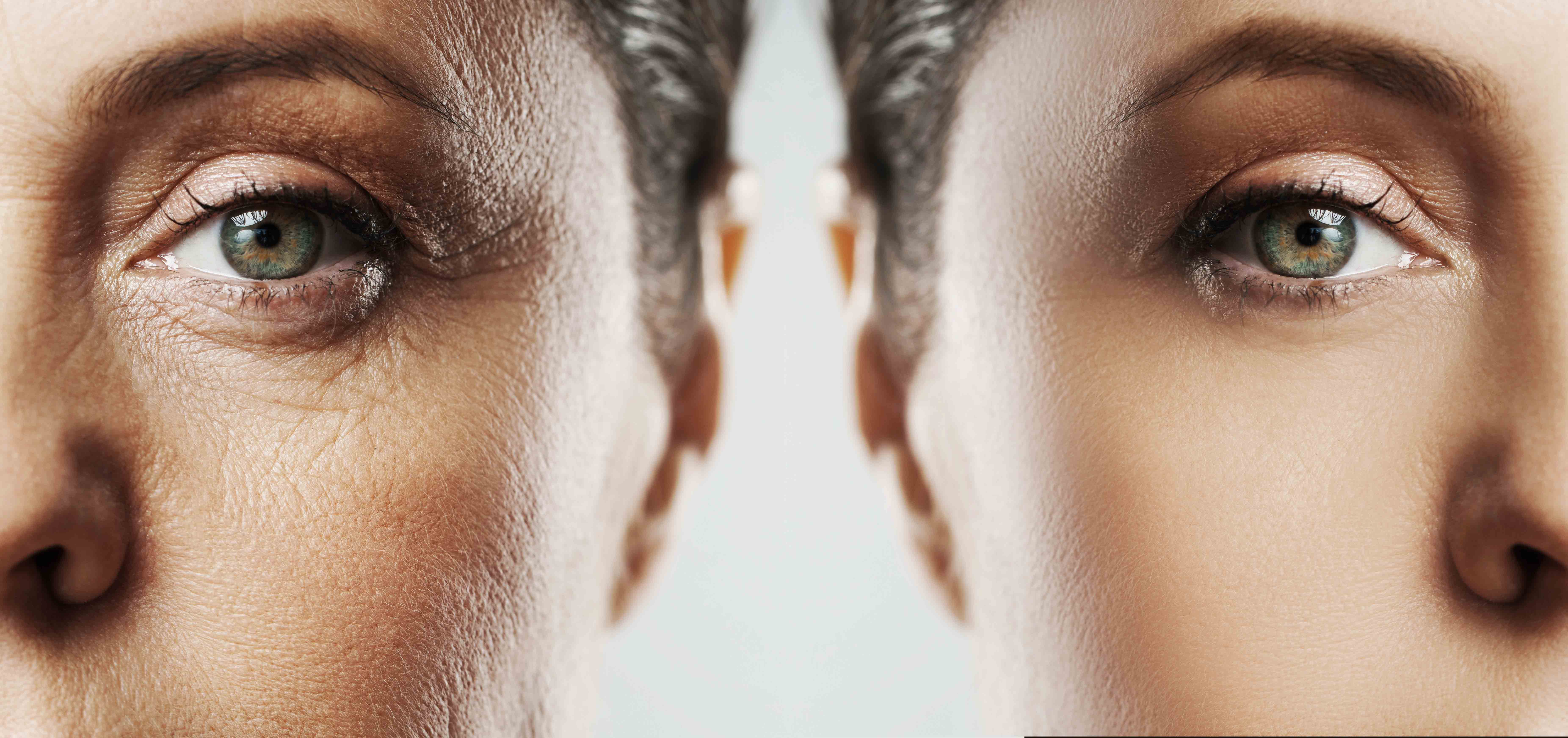 rejuvenecer4 rejuvenecer4