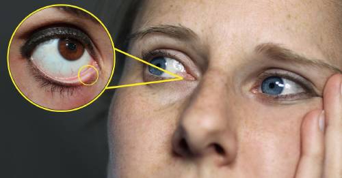 Por Que Tenemos Un Agujero Dentro Del Ojo No Es La Salida De Las Lagrimas Bioguia Por Que Tenemos Un Agujero Dentro Del Ojo No Es La Salida De Las Lagrimas Bioguia