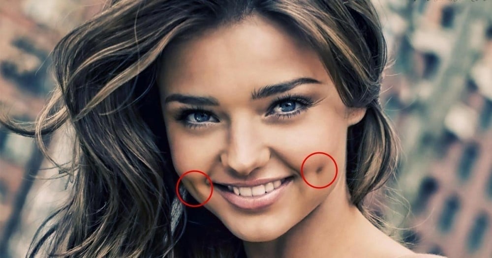 hoyuelos en las mejillas hoyuelos en las mejillas