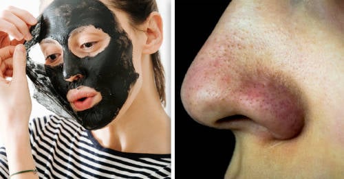 como hacer propias bandas eliminar puntos negros como hacer propias bandas eliminar puntos negros