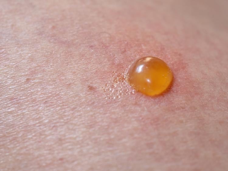 araña viuda negra araña viuda negra