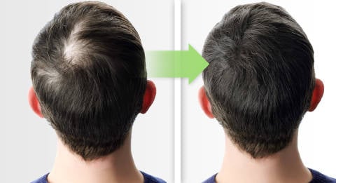 masaje capilar estimular crecimiento cabello masaje capilar estimular crecimiento cabello