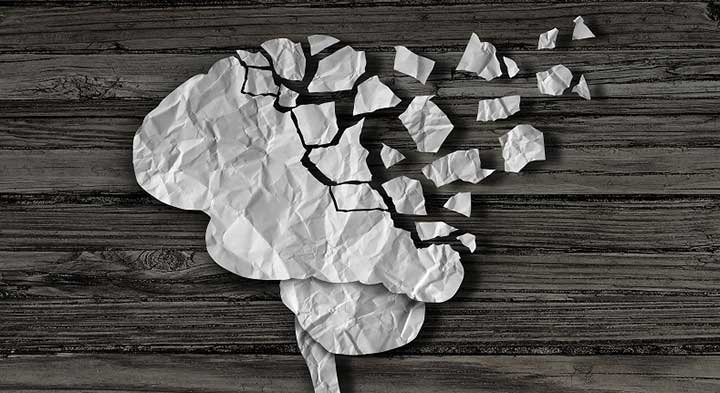 alhzéimer Alzheimer