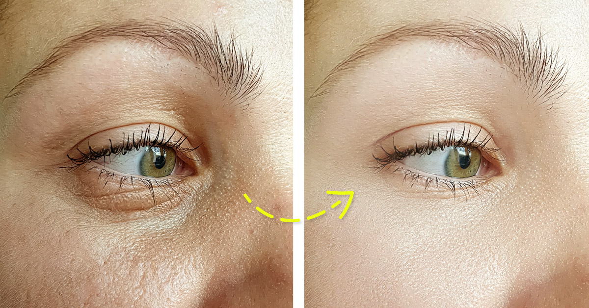 ingrediente piel porcelana ingrediente piel porcelana