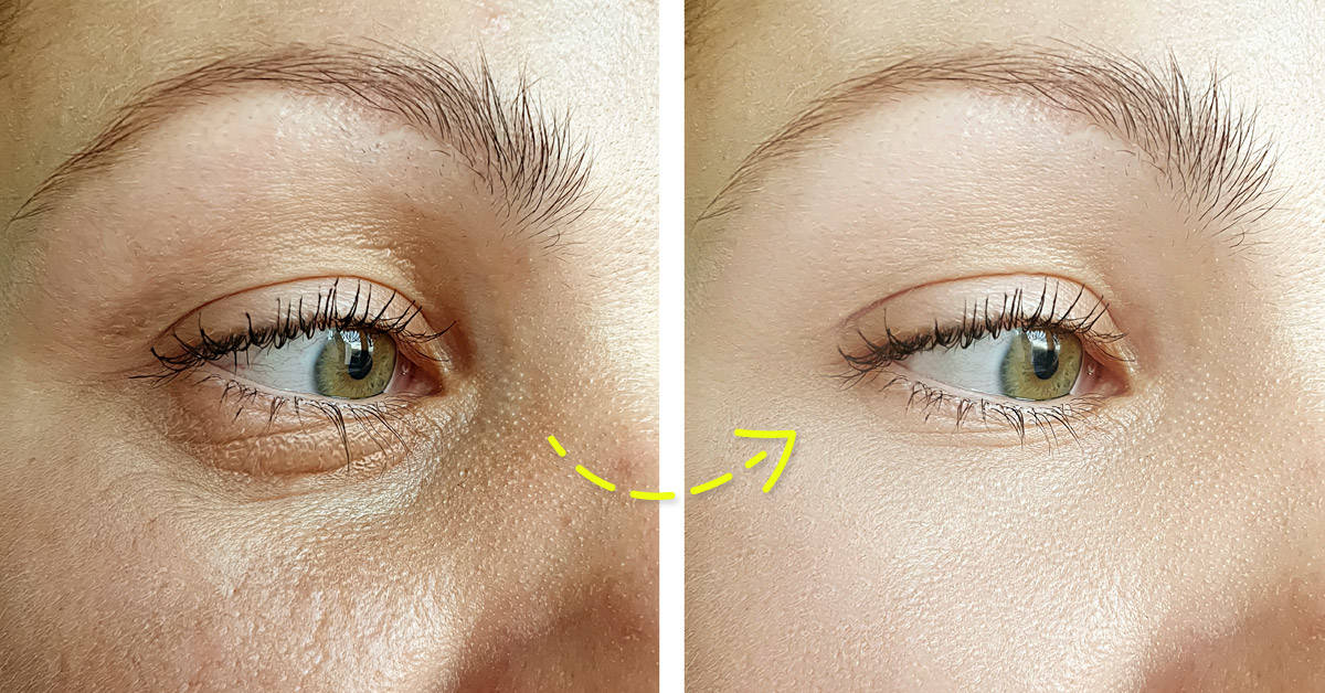 Cómo usar pepino para tener un cutis de porcelana