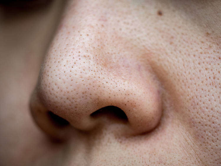 Una nariz con puntos negros