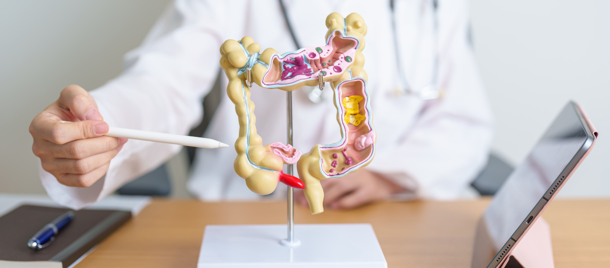 intestino AdobeStock_619645831 intestino AdobeStock_619645831