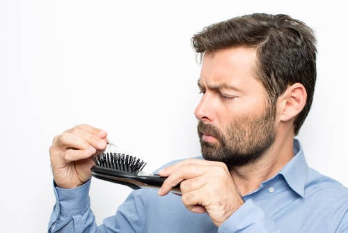 hombre caída del cabello hombre caída del cabello