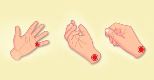 9 trucos de acupresión para aliviar dolores cotidianos 9 trucos de acupresión para aliviar dolores cotidianos
