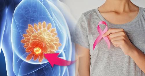 9 mitos sobre el cáncer de mama que muchos todavía se creen