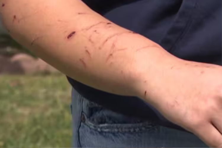 mordeduras Leones marinos mordieron a diferentes personas en la costa de California alterados por una toxina Captura/ABC