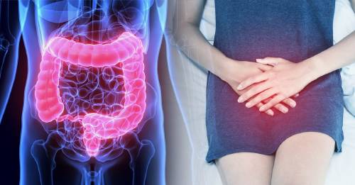 5 alimentos saludables para mantener limpios tus intestinos