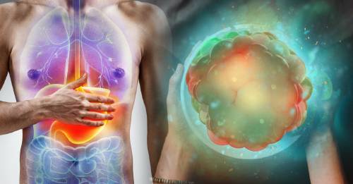 ¿Estás alimentando a tu cuerpo o al cáncer?