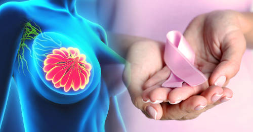 7 creencias comunes cancer mama