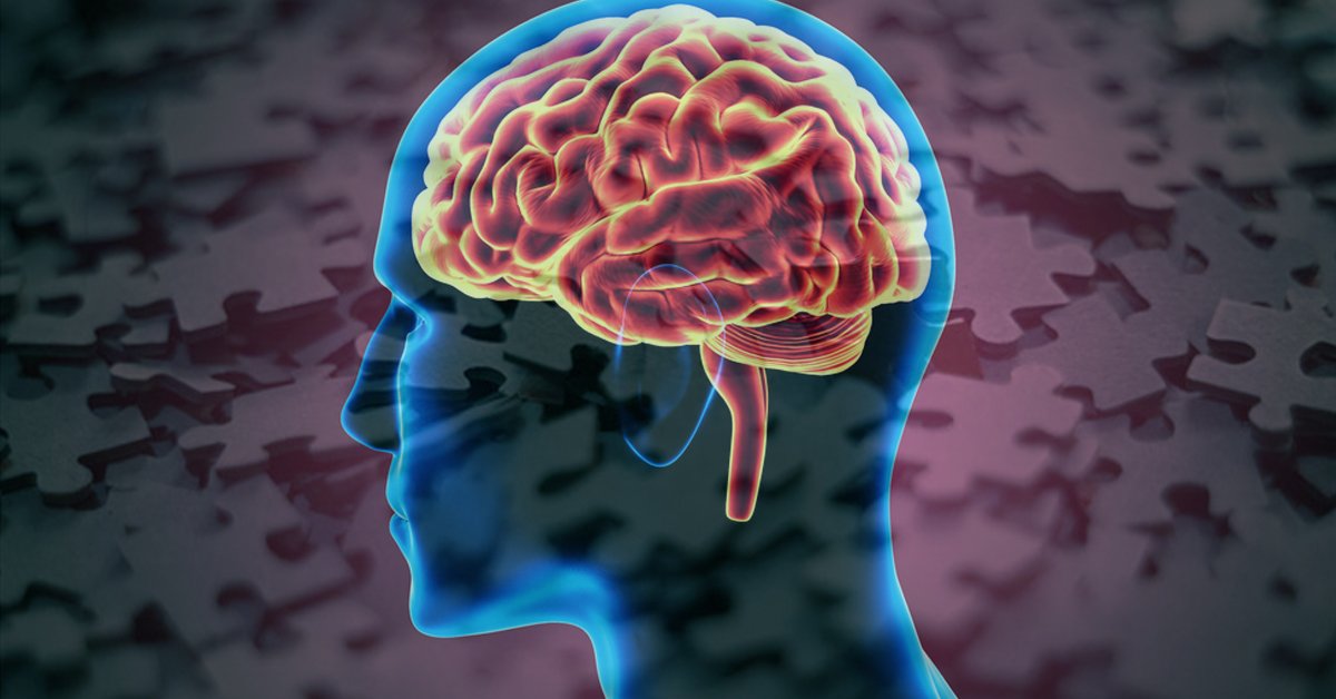 4 razones por las que tienes mala memoria y como revertirlo 4 razones por las que tienes mala memoria y como revertirlo