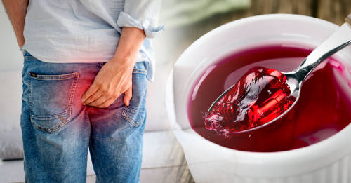 alimentos ayudan a aliviar hemorroides alimentos ayudan a aliviar hemorroides