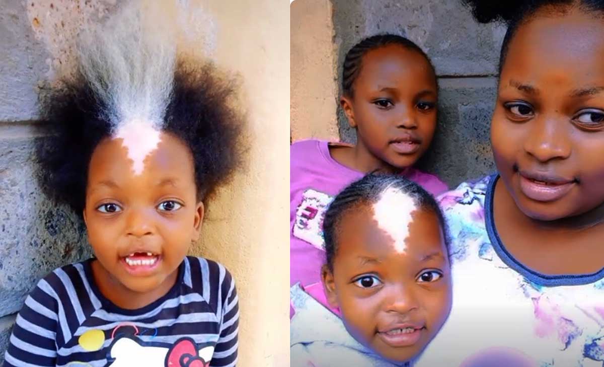 niña mancha blanca niña mancha blanca