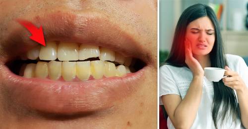 9 Cosas que tu dentista no te dice