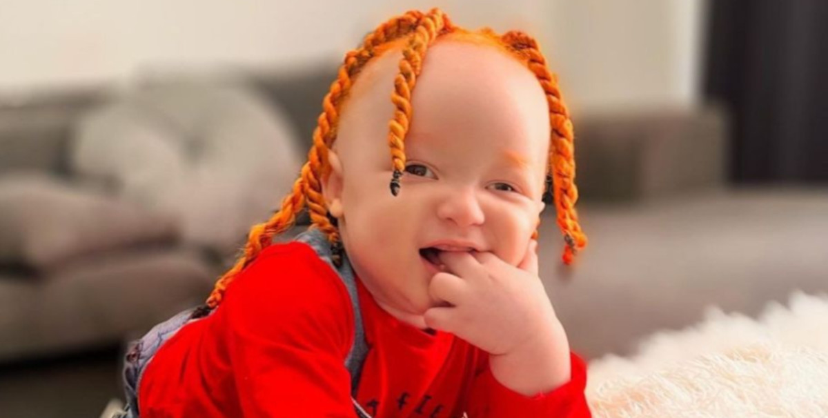 bebé albino pelirrojo bebé albino pelirrojo