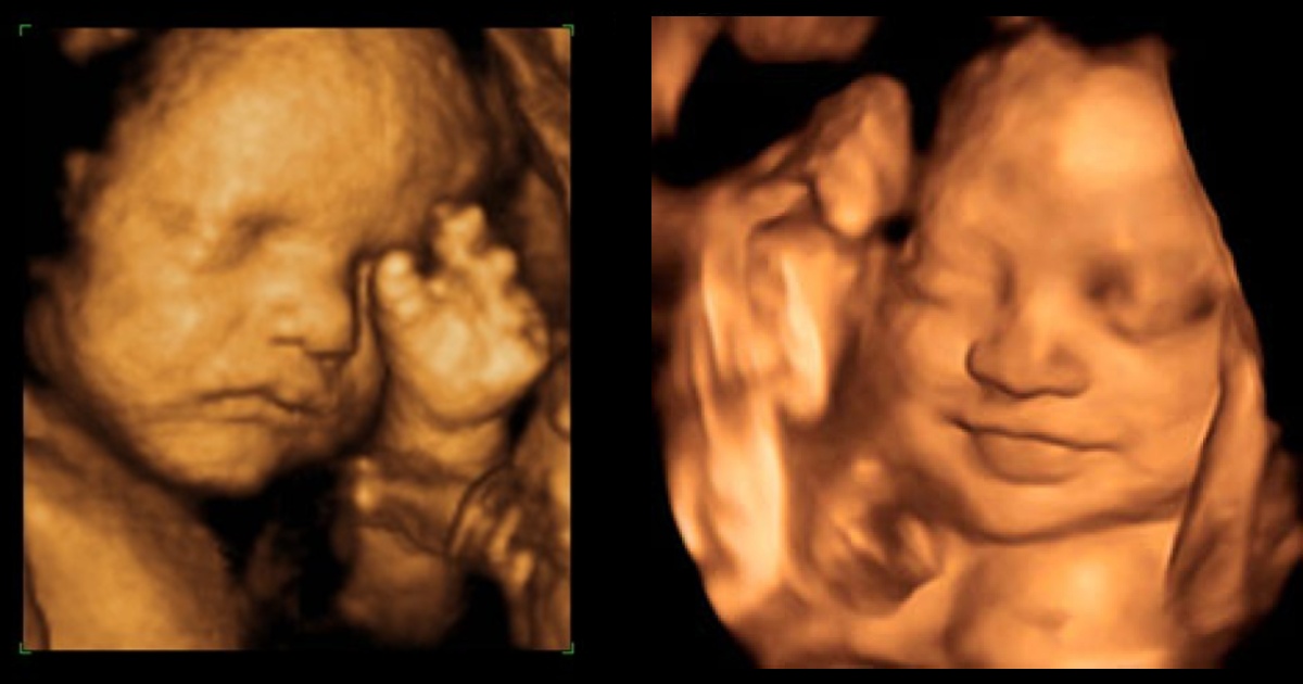 Bebé rie y llora según los gustos Bebé rie y llora según los gustos