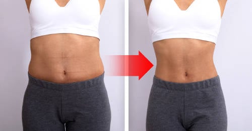 mujer antes y despues de hacer dieta y ejercicios. concepto de bajar de peso y estar en forma
