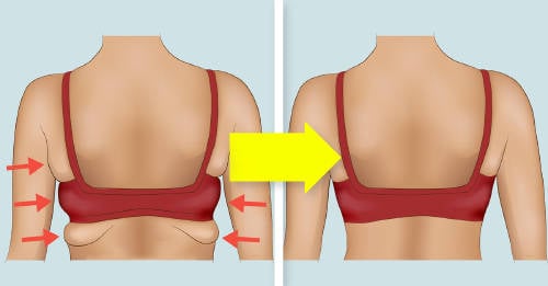 4 consejos infalibles reducir grasas axilas 4 consejos infalibles reducir grasas axilas