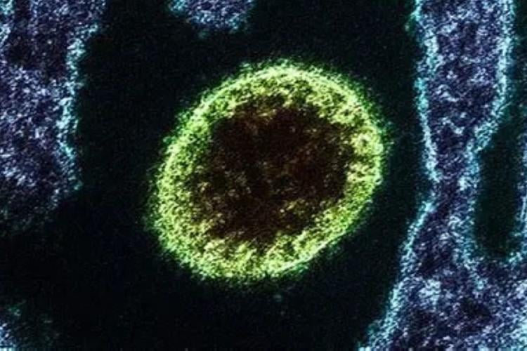 virus Se trata de un virus zoonótico, es decir, se transmite de animales a humanos. Fue detectado por primera vez en Malasia en 1999, en un brote que provocó más de 100 muertes (theobjective.com)