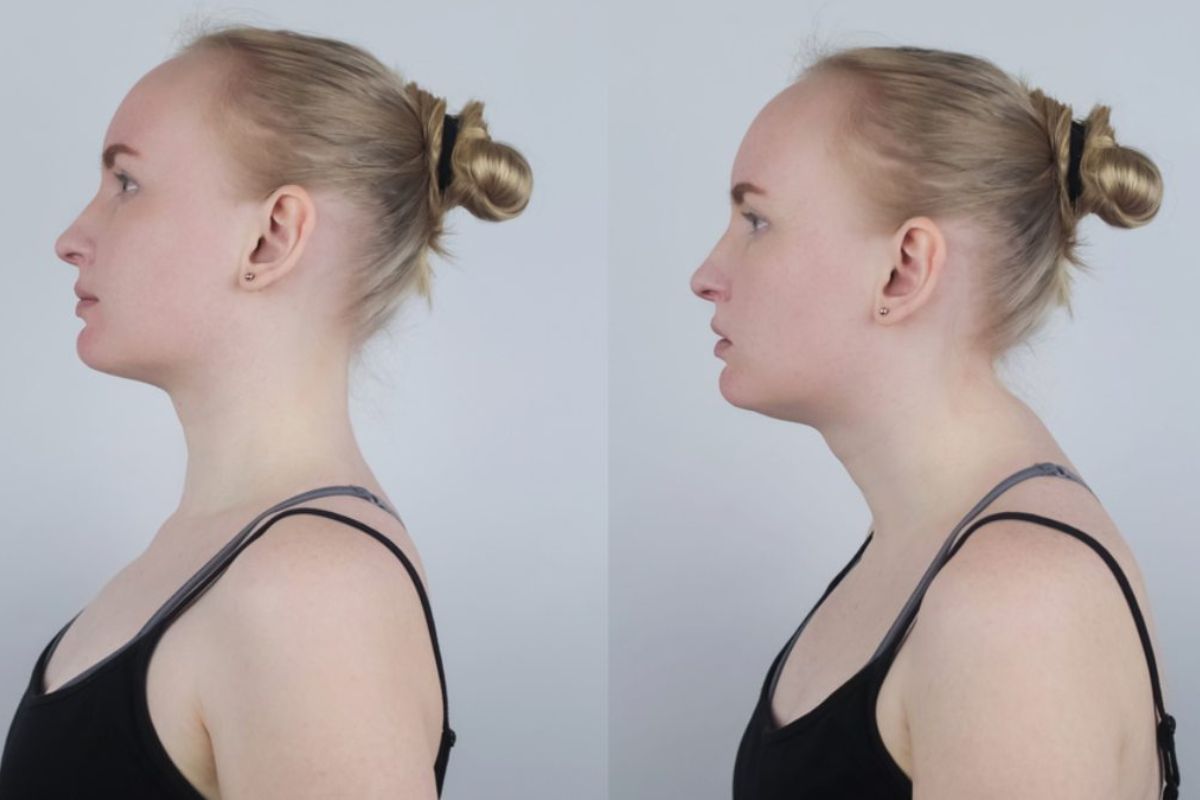 Uno de los factores centrales es la rigidez del pecho y la columna torácica, que suele permanecer “cerrada” tras años de mala postura. (Imagen: cuidateplus.marca.com)