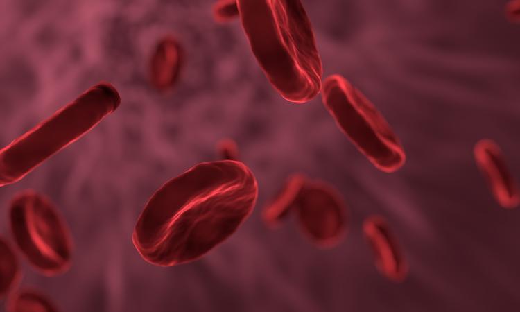 ¿Qué es la anemia? Causas, síntomas y que alimentos la evitan