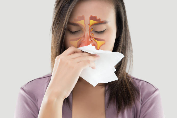 alergia Alergia al polvo