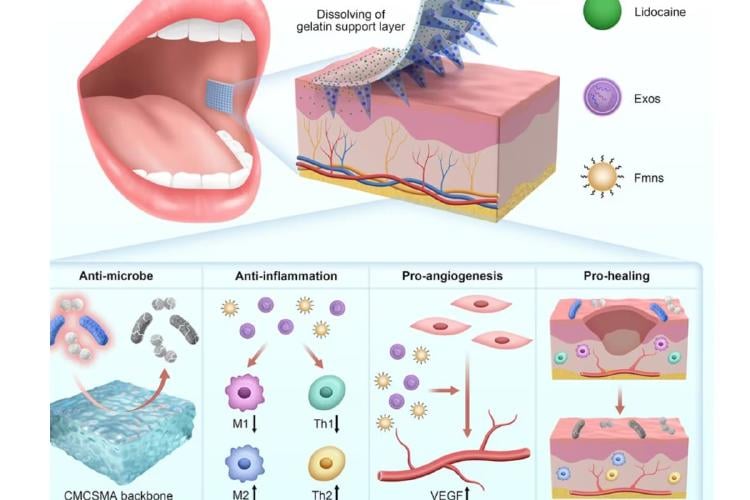 dientes Imagen: fayerweyer.com