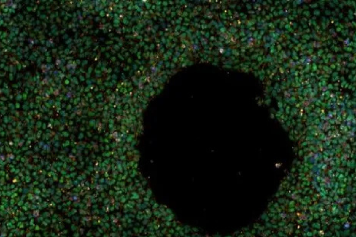 El primer banco de células madre para la investigación de la enfermedad de Alzheimer se ha denominado \"Plataforma iPSC para Modelar el Riesgo de la enfermedad de Alzheimer\" (IPMAR).Hazel Hall Roberts