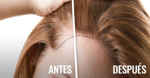 solo necesitas dos ingredientes crecer cabello solo necesitas dos ingredientes crecer cabello