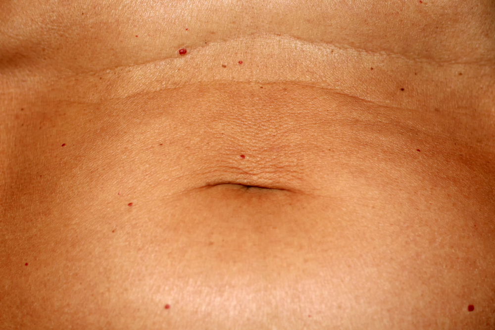 Puntos rojos que salen en la piel Puntos rojos que salen en la piel