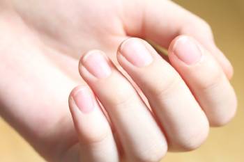líneas en las uñas  Por qué salen líneas en las uñas y cómo eliminarlas naturalmente