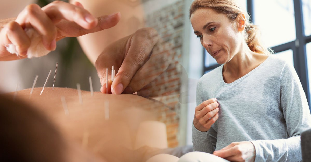beneficios practicar acupuntura menopausia beneficios practicar acupuntura menopausia