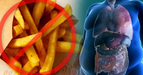 Estas son las 3 razones por las que debes dejar de comer papas fritas desde ahora Estas son las 3 razones por las que debes dejar de comer papas fritas desde ahora