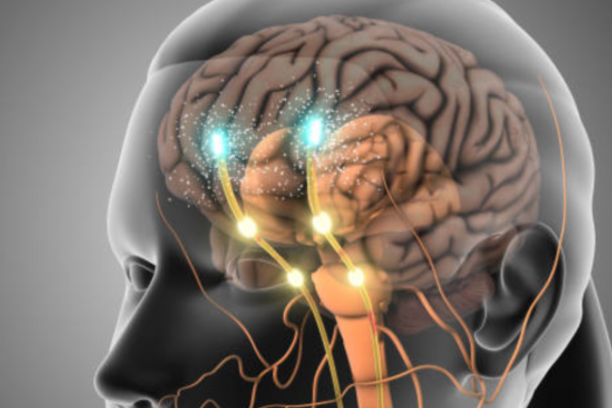 herpes en el cerebro Un impactante descubrimiento científico demostró los daños del herpes en el cerebro. (Foto: MSN)