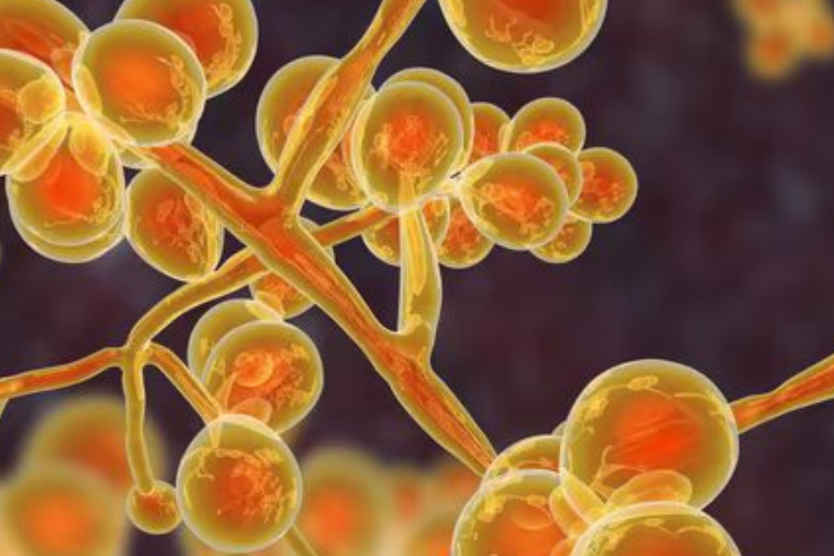 hongo Crece la alarma por el hongo más agresivo del mundo y los científicos advierten que se expande con rapidez. (Imagen: Pinterest)