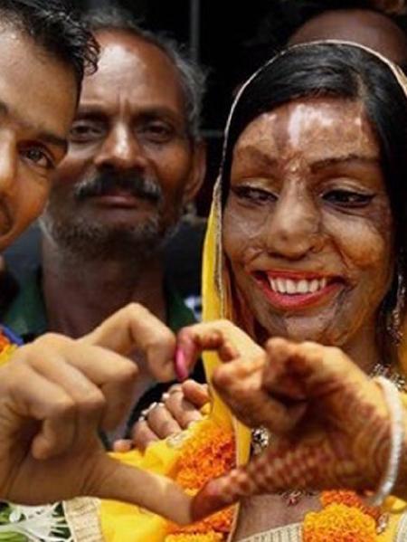 La historia de esta mujer sobreviviente a un ataque de ácido te tocará el alma La historia de esta mujer sobreviviente a un ataque de ácido te tocará el alma