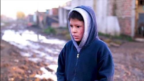 La historia del niño con piel de cristal que tiene conmovido a todo un país