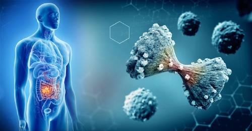Descubren que la cebolla y el ajo pueden protegernos del cáncer